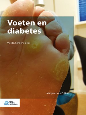 cover image of Voeten en diabetes